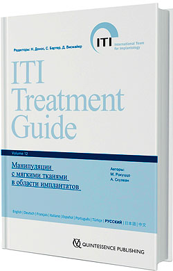 Руководство ITI по имплантологии том 12