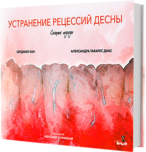 Устранение рецессий десны Серджио Кан