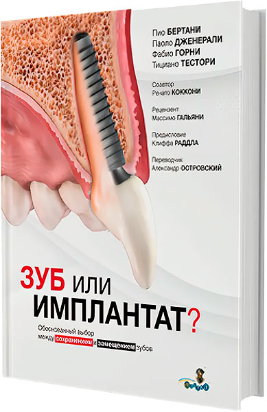 &laquo;Зуб или имплантат?&raquo; Пио Бертани, Паоло Дженерали
